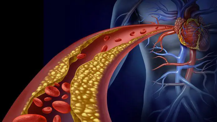 AIFA approva un farmaco che riduce i livelli di colesterolo nel sangue