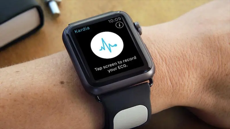 Apple Watch farà elettrocardiogramma?